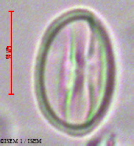 Weinmannia trichosperma - lame n° 28579